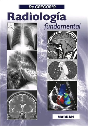 Libro Radiología Fundamental De Miguel Ángel De Gregorio