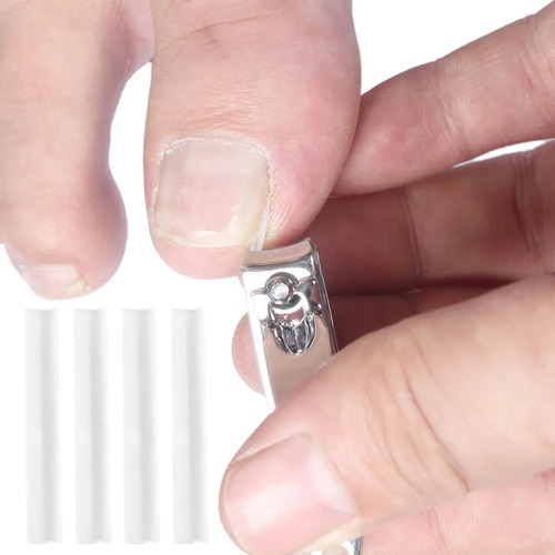 Kit De Tratamiento Para Uñas Encarnadas: Corrector,