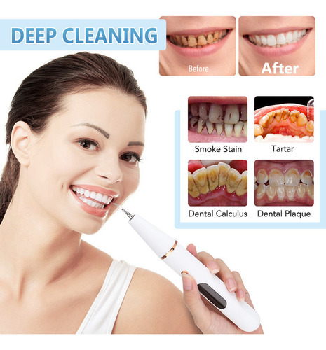 El Limpiador Dental Ultrasónico Eléctrico Dental Elimina