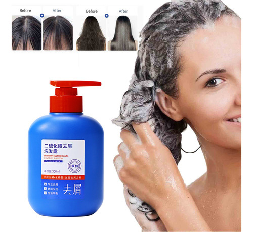 . Shampoo Para Remover Bronzeado E Caspa Com Dissulfeto D