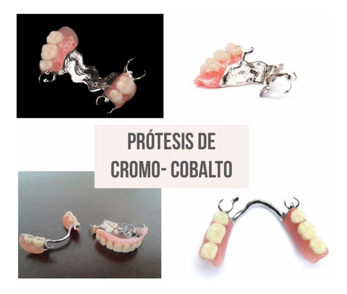 Imagen 2 de 5 de Prótesis Dental, Prótesis Fija