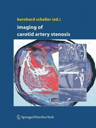 Libro Imaging Of Carotid Artery Stenosis - Bernhard J. Sc...