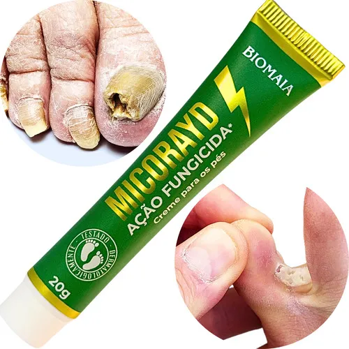 Micoses Pomada Nail Repair O Melhor Unha Sana Unhasana Mão E Pé A...