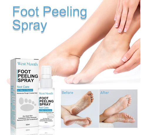 X Skin Moisturize Nutre Tus Pies En La Estación Seca, 50