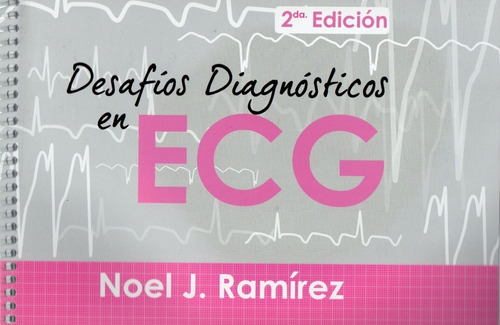 Desafíos Diagnósticos En Ecg. Ramírez