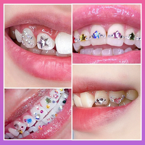 Teeth Gems Tooth Gems, Kit De Joyas, Cristales, Bricolaje