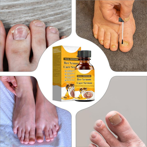 // Aceite Reparador De Uñas Aceite Protector De Uñas 15 Ml