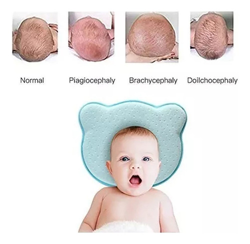 Yy Almofada De Prevenção Para Bebês Recém-nascidos, Espuma