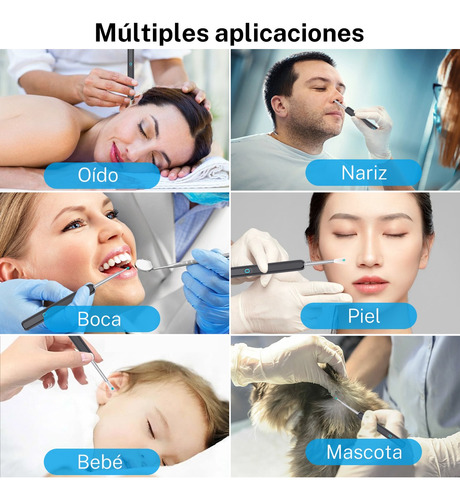 Limpia Oídos Cámara Inteligente Extractor De Cera Endoscopio
