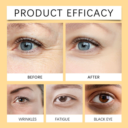 I Creme Para Os Olhos Com Cafeína