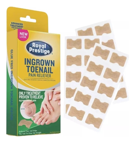 50 Parches Correctores Uñas Enterradas Uñeros Adhesivos