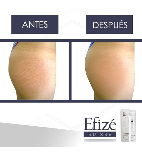 Imagen 3 de 6 de Desvanece Las Estrias - Stretch-skin - Formula Suiza