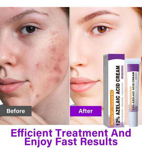 Rosto Facial Azelaico Azelaico Para Aliviar A Vermelhidão Fa