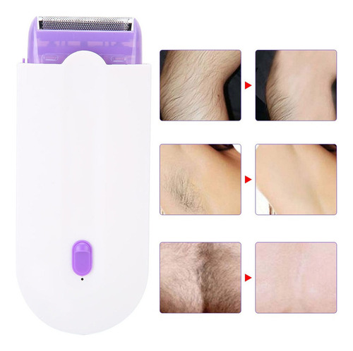 Máquina Portátil De Depilação A Laser Indolor Para Todo O