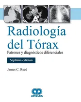 Comprar Radiologia De Torax, Patrones Y Diagnosticos Diferenciales