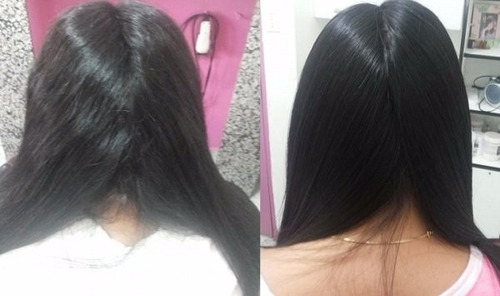 Let Me Be Escova Progressiva 1 Litro - 5 Unidades