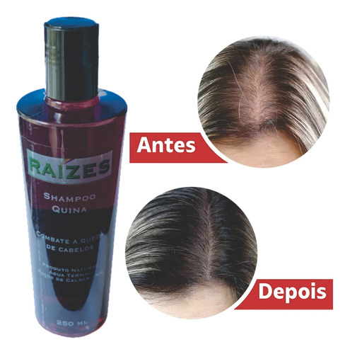 Shampoo Quina Antiqueda Feito Com Água Medicinal 250ml