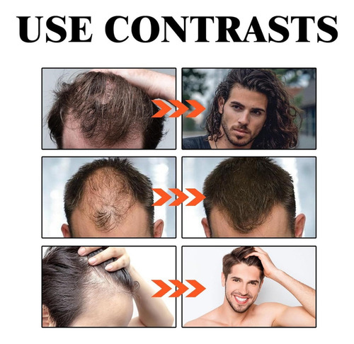 Suero De Péptidos De Cobre Para La Caída Del Cabello 3pcs