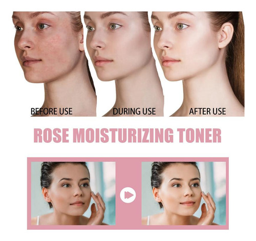 Spray Hidratante De Agua De Rosas De 100 Ml Para Rostro Con
