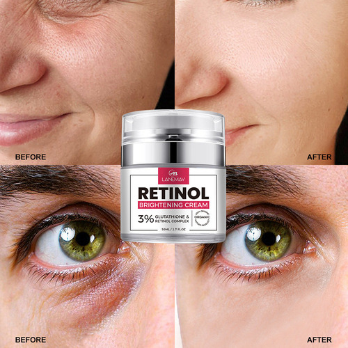 Creme De Retinol Para Rosto Para Olhos Iaging Facial Skin Ca