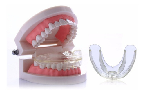 Ortodoncia Invisible En Cuotas Adultos Bracket Agnovedades