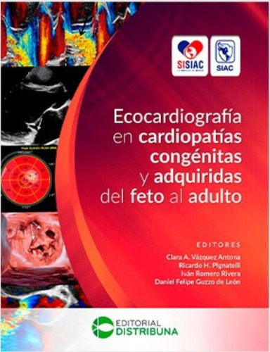 Ecocardiografa En Cardiopatas Congnitas Y Adquiri Edjouu.25