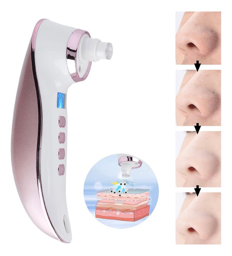 Succionador Diamante Microdermoabrasion Acné Espinillas