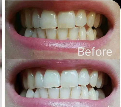 Pasta Dental Blanqueadora Ap24 Nuskin - No1 Usa!