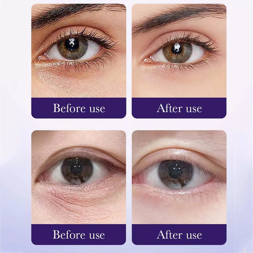 Parches Hidrogel Para Eliminar Ojeras Sadoer Semillas De Uva Todo Tipo De Piel Día/noche