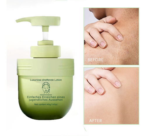 Creme Antídeo Hidratante Eficaz E Hidratante Hidratante Para