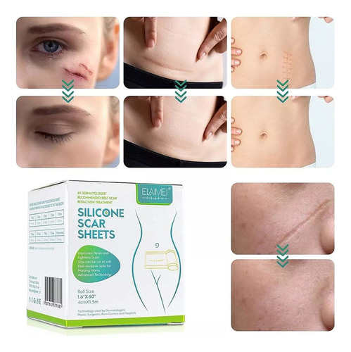 Faixa Fita De Gel Abdominoplastia Cicatriz Queloide