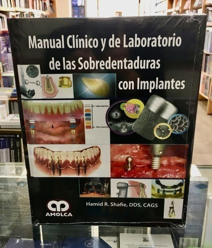 Libro - Manual Clínico Y De Laboratorio De Las Sobredentadur