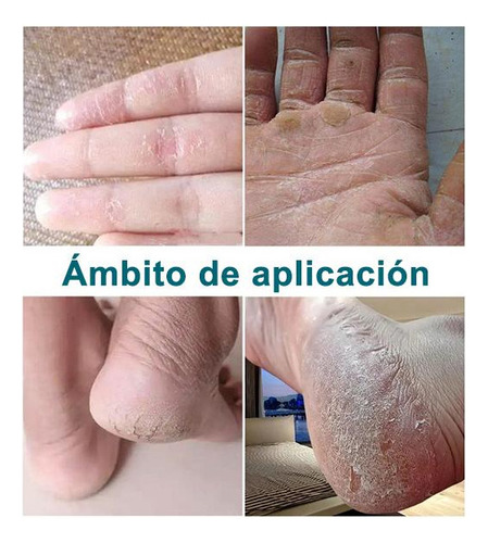 // Artken Reparación Para Pies Agrietados Y Resecos - Crema