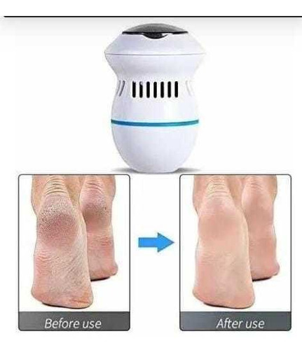 Removedor De Callos Electrónico Para Pies Talón Pulidor Lim