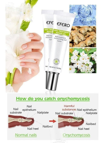 Gel Para Eliminar Fungos Nas Unhas, 2 Unidades