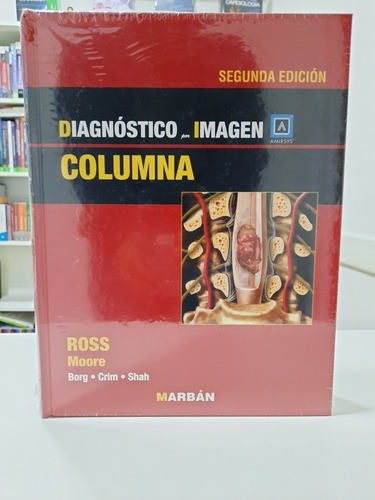 Columna Diagnostico Por Imagen Ross Marban