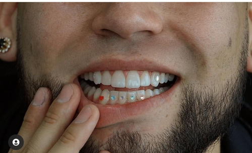 Imagen 5 de 5 de Joyas Dentales
