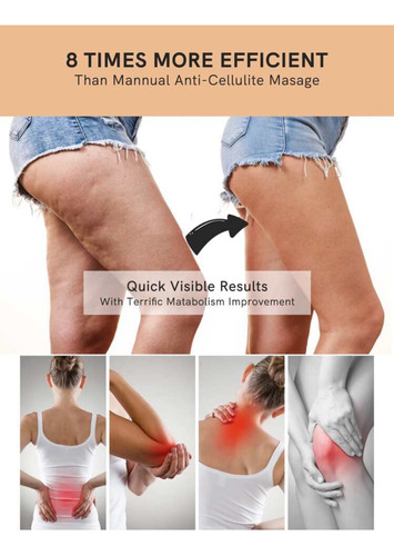 Masajeador Corporal,herramienta De Masaje,anti Celulitis