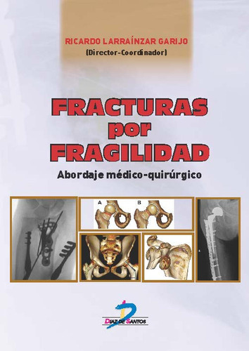 Libro Fracturas Por Fragilidad