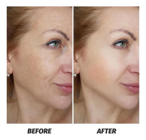Suero Facial Vgo Para Suero De La Cara De Vitamina C De La E