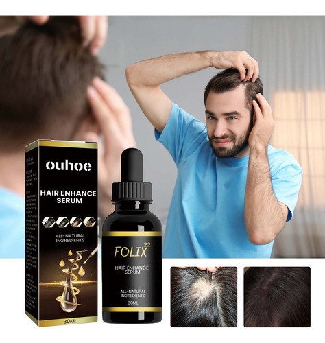 S Hair Growth Formula, Hair Growth Serum,hair Growth Oi 1011
