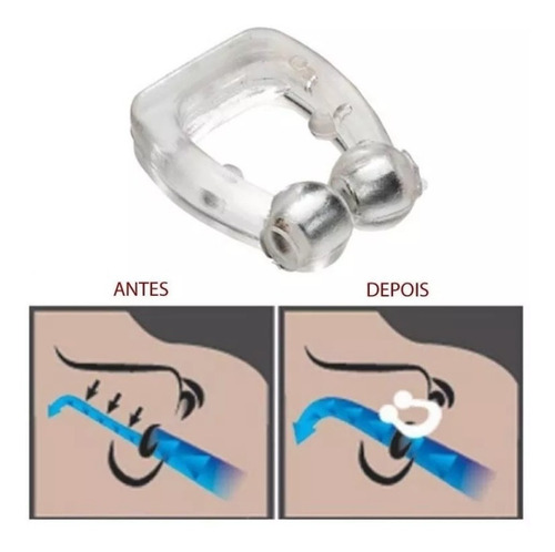 Imagem 7 de 10 de Anti Ronco Clip Nasal E Apnéia Magnetismo Nose Clip Original
