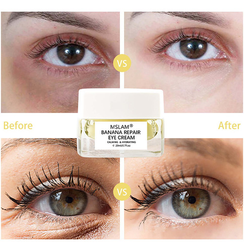 Crema Nutritiva Para Ojos E Banana Que Elimina Bolsas Y Negr