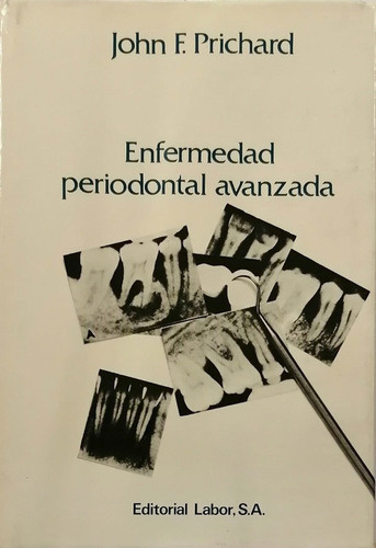 Enfermedad Periodontal Avanzada - Prichard