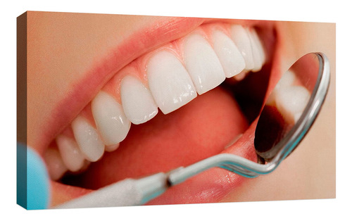 Cuadro Decorativo Canvas Moderno Odontologia Dentadura Color Odontologia Dentadura 3 Armazón Natural