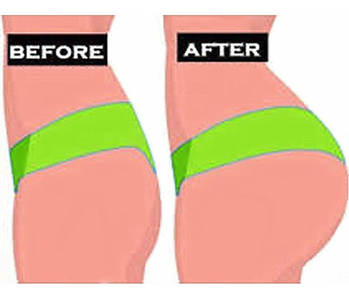 Rosa Hip Trainer Butt Lift Levantami
