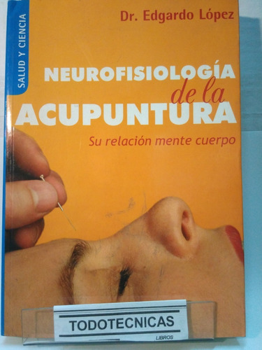 Neurofisiologia De La Acupuntura - Edgardo Lopez-   -srn