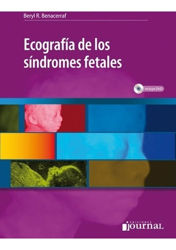 Ecografía De Los Síndromes Fetales + Cd