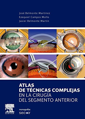 Libro Atlas De Técnicas Complejas En La Cirugía Del Segmento