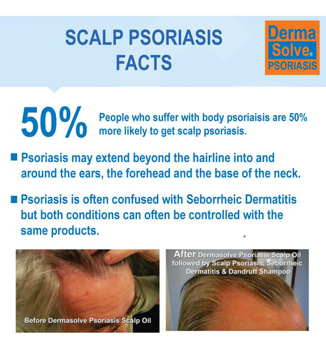 Dermasolve Champú Para La Psoriasis Y Acondicionador En Spra